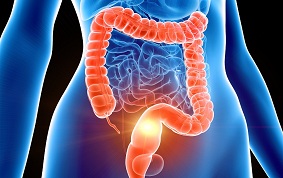 ITEM 15 – CANCERS COLORECTAUX