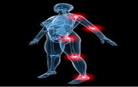 ITEM 06 – ARTHRITE SEPTIQUE