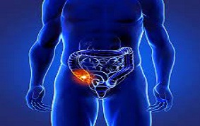 ITEM 57 – PÉRITONITES AIGUËS