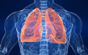 ITEM 72 – TUBERCULOSES PULMONAIRES COMMUNES